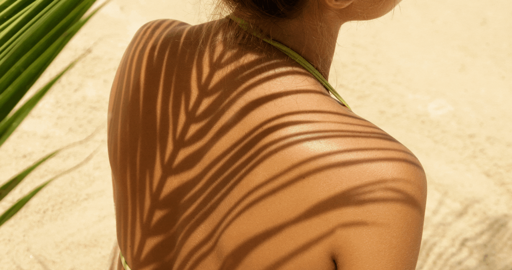 How to Soothe Sunburns with CBD Body Oil